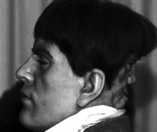 edward mordrake